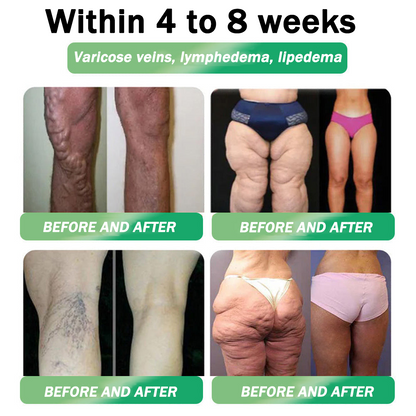 𝐎𝐟𝐟𝐢𝐳𝐢𝐞𝐥𝐥𝐞𝐫 𝐒𝐭𝐨𝐫𝐞 | 🌟🌟 𝐇𝐇𝐕𝐁® 𝐍𝐀𝐃+ 𝐆𝐋𝐏-𝟏 𝐏𝐫𝐨 𝐀𝐋𝐋-𝐈𝐍-𝐎𝐍𝐄 𝐅𝐢𝐭&𝐕𝐢𝐭𝐚𝐥 𝐅𝐥ü𝐬𝐬𝐢𝐠𝐤𝐞𝐢𝐭 𝐳𝐮𝐫 𝐄𝐢𝐧𝐧𝐚𝐡𝐦𝐞 (𝐍𝐮𝐫 𝐞𝐢𝐧𝐦𝐚𝐥 𝐭ä𝐠𝐥𝐢𝐜𝐡, 𝐬𝐢𝐜𝐡𝐭𝐛𝐚𝐫𝐞 𝐕𝐞𝐫ä𝐧𝐝𝐞𝐫𝐮𝐧𝐠𝐞𝐧 𝐢𝐧 𝟕 𝐓𝐚𝐠𝐞𝐧)