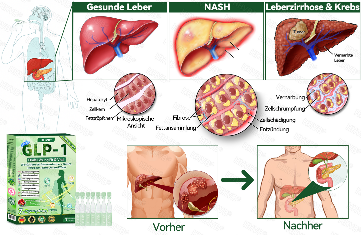 𝐎𝐟𝐟𝐢𝐳𝐢𝐞𝐥𝐥𝐞𝐫 𝐒𝐭𝐨𝐫𝐞 | 🌟🌟 𝐇𝐇𝐕𝐁® 𝐍𝐀𝐃+ 𝐆𝐋𝐏-𝟏 𝐏𝐫𝐨 𝐀𝐋𝐋-𝐈𝐍-𝐎𝐍𝐄 𝐅𝐢𝐭&𝐕𝐢𝐭𝐚𝐥 𝐅𝐥ü𝐬𝐬𝐢𝐠𝐤𝐞𝐢𝐭 𝐳𝐮𝐫 𝐄𝐢𝐧𝐧𝐚𝐡𝐦𝐞 (𝐍𝐮𝐫 𝐞𝐢𝐧𝐦𝐚𝐥 𝐭ä𝐠𝐥𝐢𝐜𝐡, 𝐬𝐢𝐜𝐡𝐭𝐛𝐚𝐫𝐞 𝐕𝐞𝐫ä𝐧𝐝𝐞𝐫𝐮𝐧𝐠𝐞𝐧 𝐢𝐧 𝟕 𝐓𝐚𝐠𝐞𝐧)