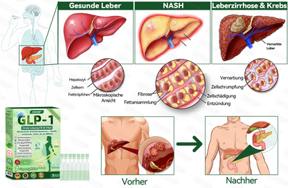 𝐎𝐟𝐟𝐢𝐳𝐢𝐞𝐥𝐥𝐞𝐫 𝐒𝐭𝐨𝐫𝐞 | 🌟🌟 𝐇𝐇𝐕𝐁® 𝐍𝐀𝐃+ 𝐆𝐋𝐏-𝟏 𝐏𝐫𝐨 𝐀𝐋𝐋-𝐈𝐍-𝐎𝐍𝐄 𝐅𝐢𝐭&𝐕𝐢𝐭𝐚𝐥 𝐅𝐥ü𝐬𝐬𝐢𝐠𝐤𝐞𝐢𝐭 𝐳𝐮𝐫 𝐄𝐢𝐧𝐧𝐚𝐡𝐦𝐞 (𝐍𝐮𝐫 𝐞𝐢𝐧𝐦𝐚𝐥 𝐭ä𝐠𝐥𝐢𝐜𝐡, 𝐬𝐢𝐜𝐡𝐭𝐛𝐚𝐫𝐞 𝐕𝐞𝐫ä𝐧𝐝𝐞𝐫𝐮𝐧𝐠𝐞𝐧 𝐢𝐧 𝟕 𝐓𝐚𝐠𝐞𝐧)