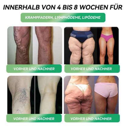𝐇𝗛𝑉𝖡® 🇩🇪 6-in-1-𝐆𝗟𝑷-1-Gesundheitsformel 🏆🏆, 𝐟𝐥ü𝐬𝐬𝐢𝐠 𝐳𝐮𝐦 𝐄𝐢𝐧𝐧𝐞𝐡𝐦𝐞𝐧 (Nur eine Dosis pro Tag, sichtbare Veränderungen in 7 Tagen) ✅ Für Fettleibigkeit, kardiovaskuläre Gesundheit, Diabetes, Schlafapnoe, Gelenkprobleme und mehr.